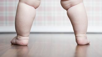 genetische-obesitas