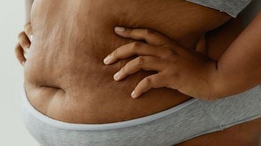 postpartum lichaam na drielingzwangerschap