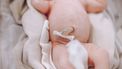 Baby die net geboren is en waarbij geen navelstrengbloed is opgeslagen