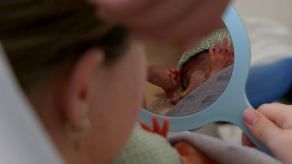 baby cas 1
